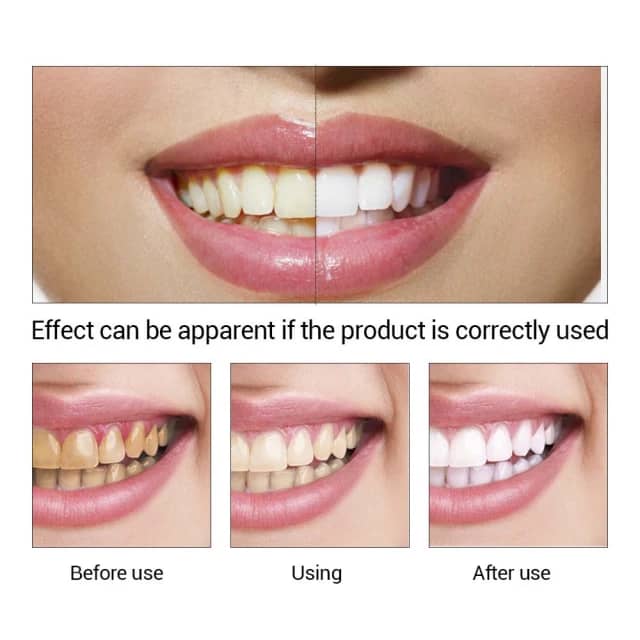محلول سفید کننده دندان لانبنا