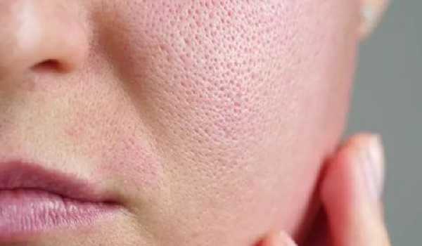 ماسک خانگی برای منافذ باز پوست