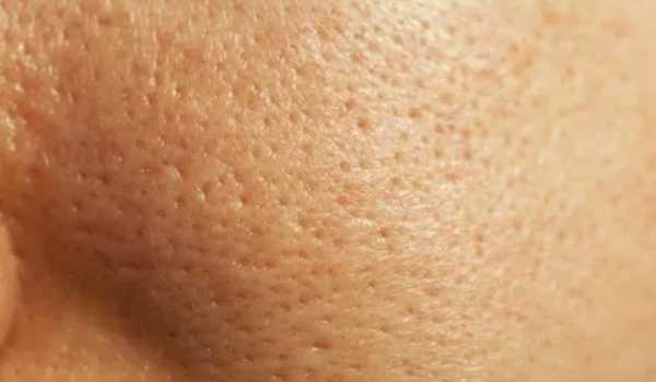 ماسک خانگی پاک کننده منافذ پوست