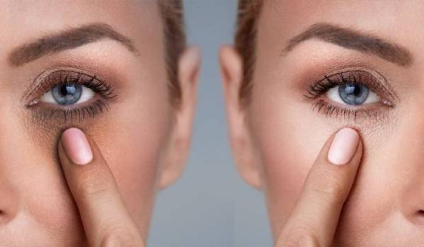 ماسک خانگی تیرگی دور چشم