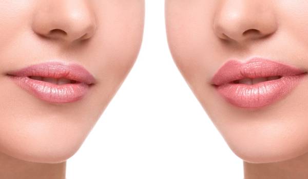 ماسک دارچین و روغن نارگیل برای حجمدهی لب