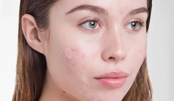 بهترین ضد لک صورت خارجی چیست؟ 