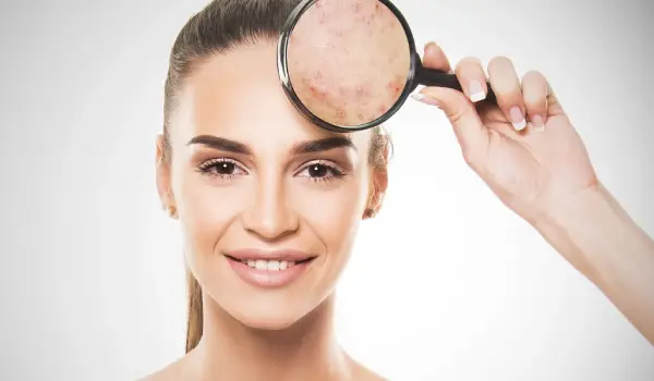 بهترین کرم ترمیم کننده بعد از برداشتن خال