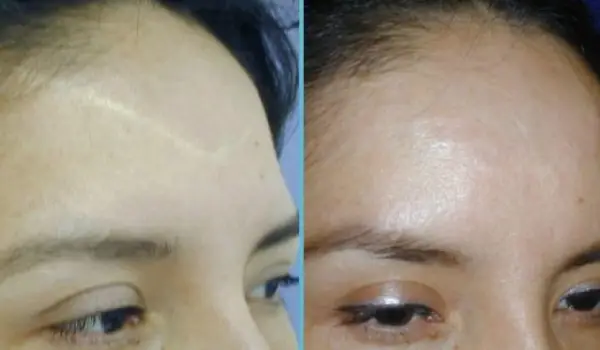 بهترین کرم ترمیم کننده پوست صورت خارجی