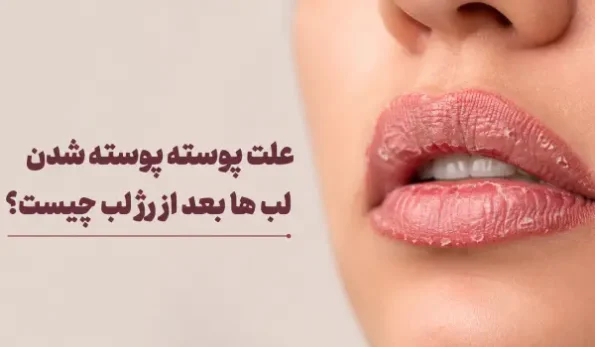 علت پوسته پوسته شدن لب ها بعد از رژ لب چیست؟