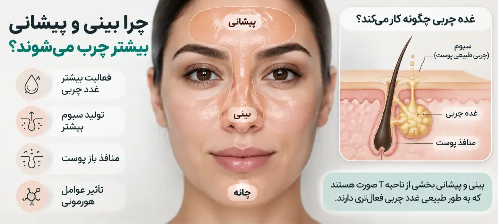 چرا فقط بینیام چرب است؟