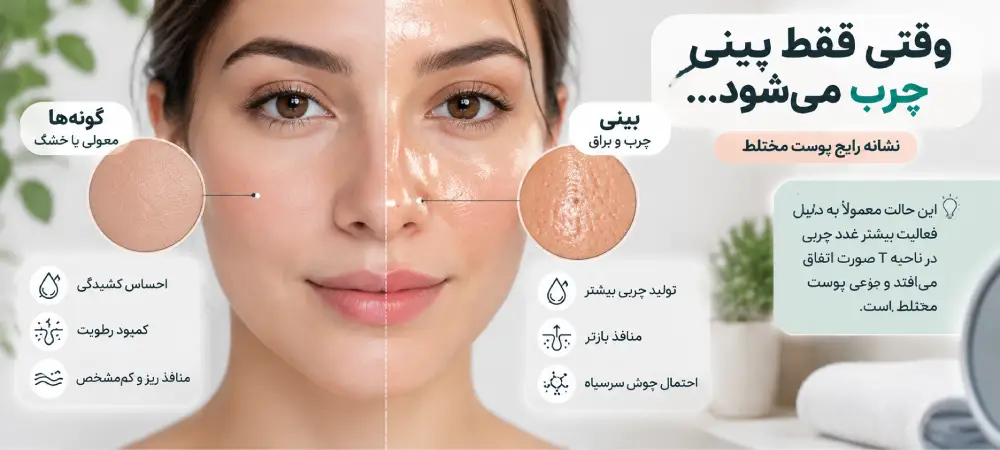 علت چرب شدن بینی بعد از خواب